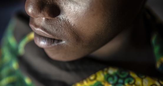 Stigma_Woman from DRC_War Child in Congo_180628